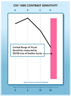 CSV 1000 Contrast sensitivity