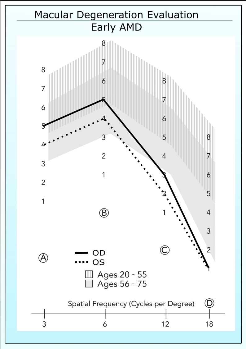 Early ARMD patient