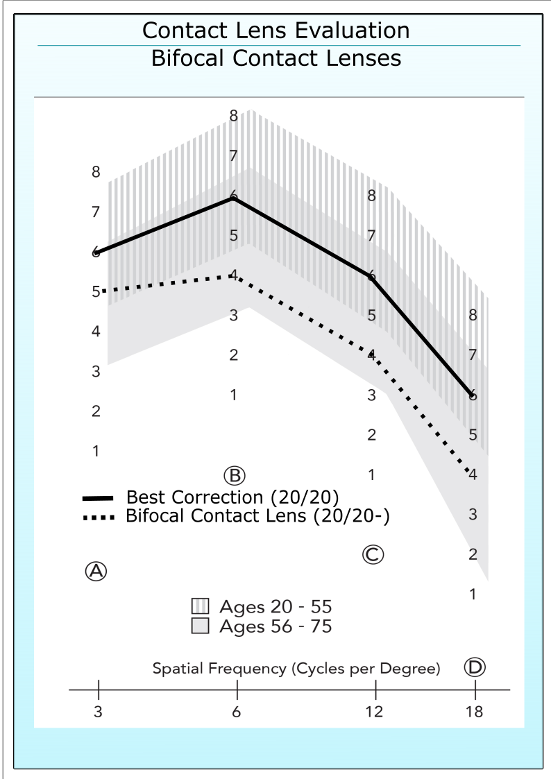 Bifocal Contact Lens