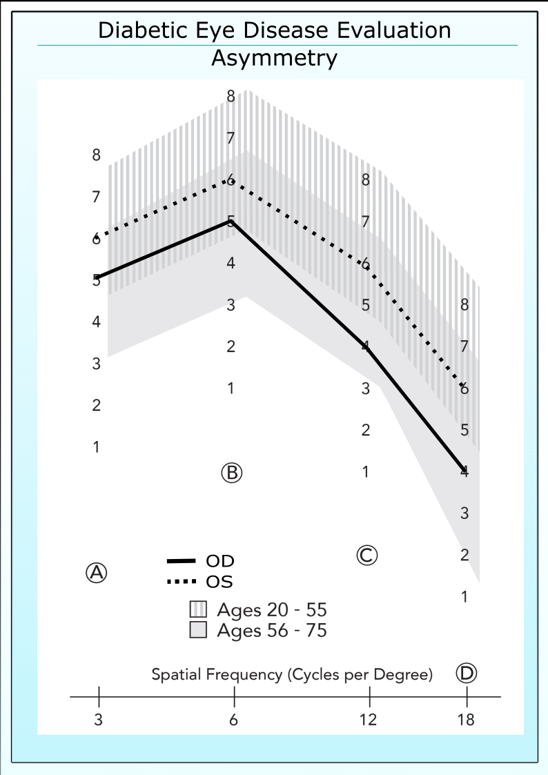 Asymmetric contrast sensitivity in a 20/20 diabetic patient with no retinopathy