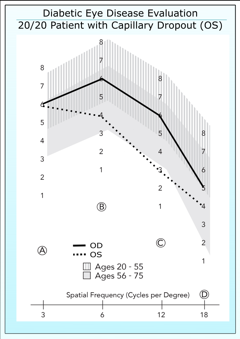 20/20 diabetic patient with areas of capillary dropout