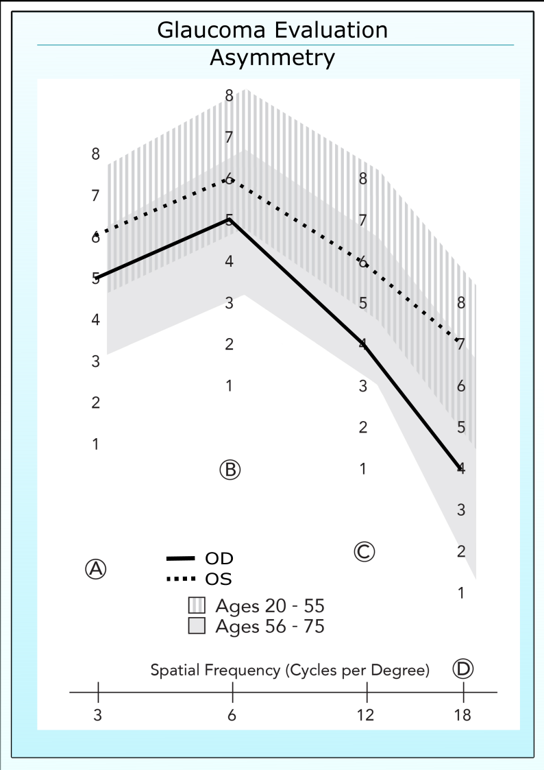 Glaucoma patients with asymmetry in contrast sensitivity between eyes