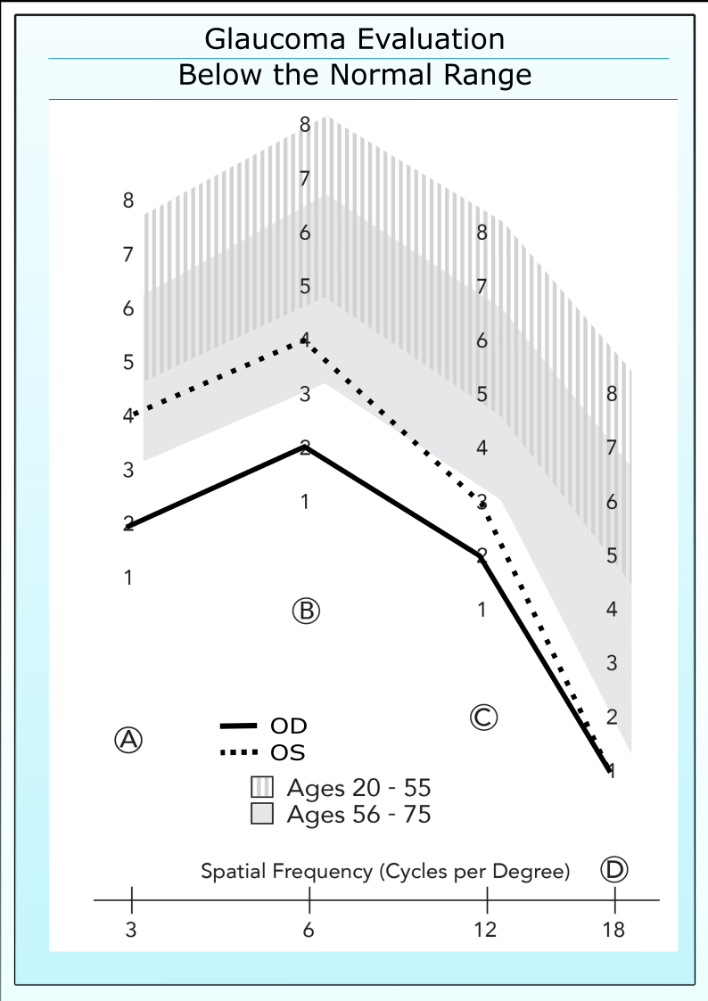 Untreated glaucoma patient with contrast sensitivity below the normal range.