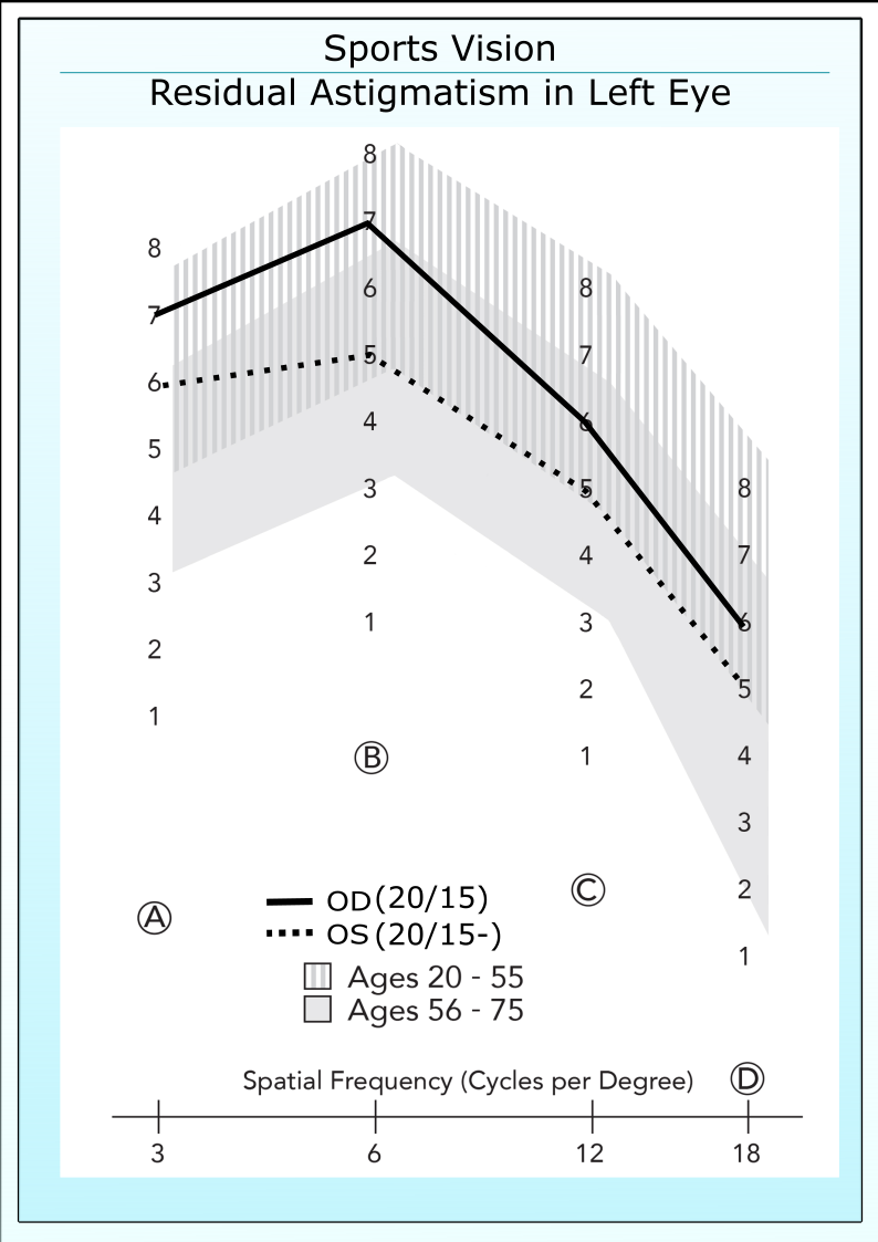 Athlete with residual astigmatism in left eye